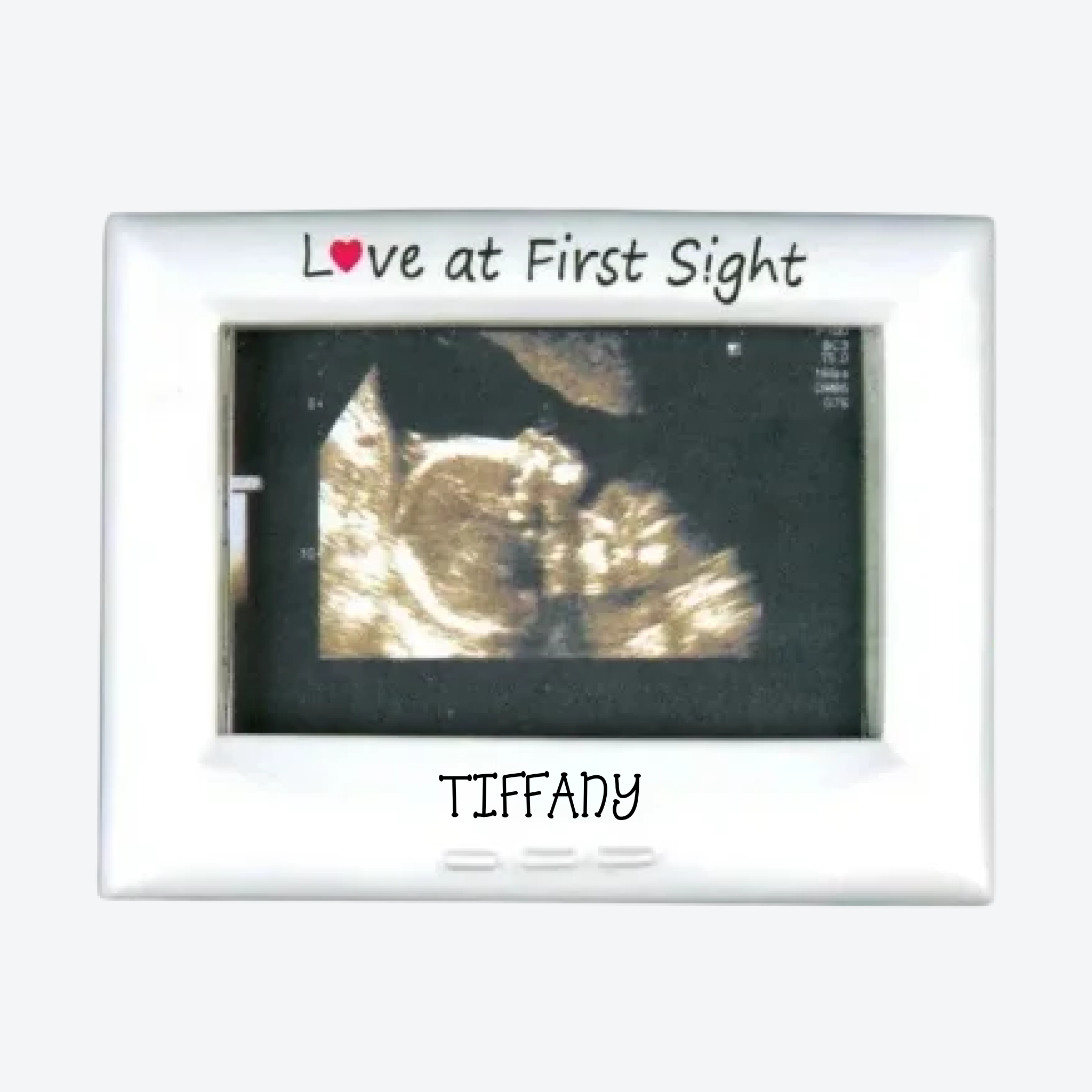 Ultra Sound Frame Personalized Christmas Ornaments